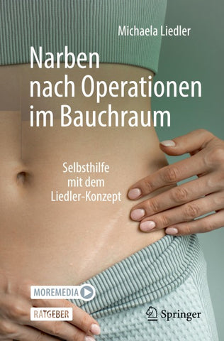 Narben nach Operationen im Bauchraum