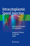 Intracytoplasmic Sperm Injection