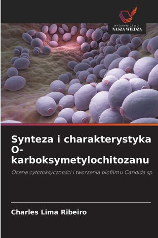 Synteza i charakterystyka O-karboksymetylochitozanu