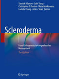 Scleroderma