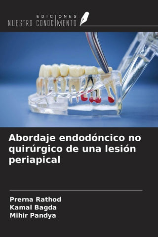 Abordaje endodóncico no quirúrgico de una lesión periapical