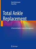 Total Ankle Replacement
