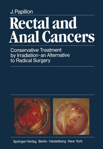 Rectal and Anal Cancers