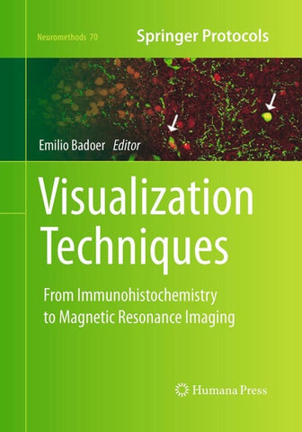 Visualization Techniques