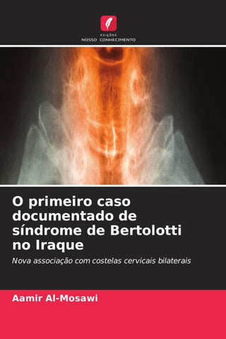 O primeiro caso documentado de síndrome de Bertolotti no Iraque