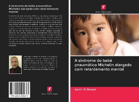 A síndrome do bebé pneumático Michelin alargado com retardamento mental
