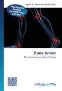 Bone tumor