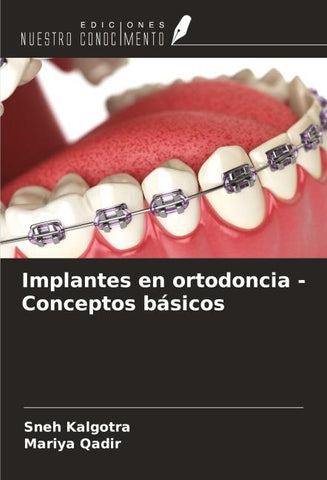 Implantes en ortodoncia - Conceptos básicos
