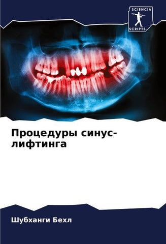 Procedury sinus-liftinga