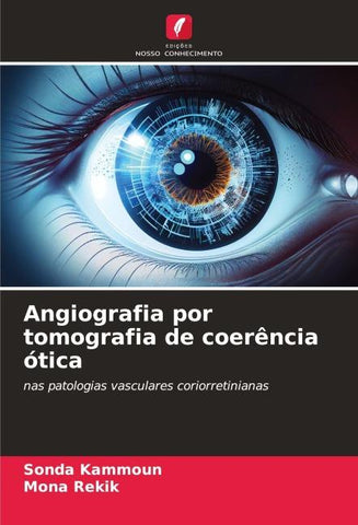 Angiografia por tomografia de coerência ótica