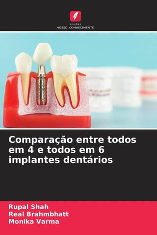 Comparação entre todos em 4 e todos em 6 implantes dentários