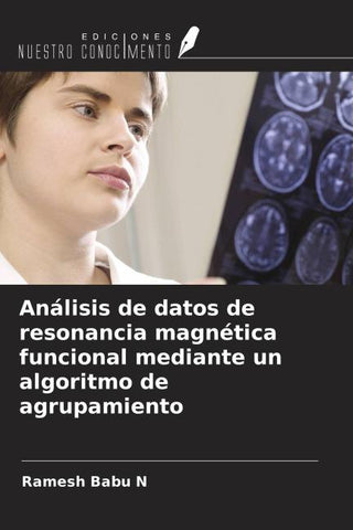 Análisis de datos de resonancia magnética funcional mediante un algoritmo de agrupamiento
