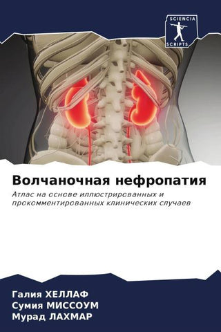 Volchanochnaq nefropatiq