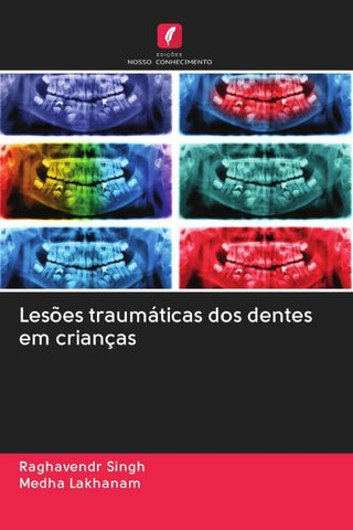 Lesões traumáticas dos dentes em crianças