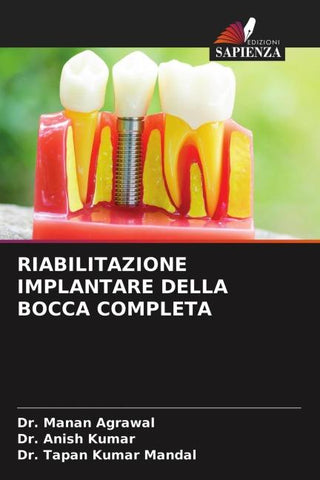 RIABILITAZIONE IMPLANTARE DELLA BOCCA COMPLETA