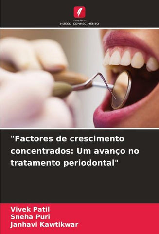 "Factores de crescimento concentrados: Um avanço no tratamento periodontal"