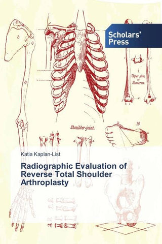 Radiographic Evaluation of Reverse Total Shoulder Arthroplasty