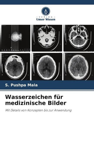 Wasserzeichen für medizinische Bilder
