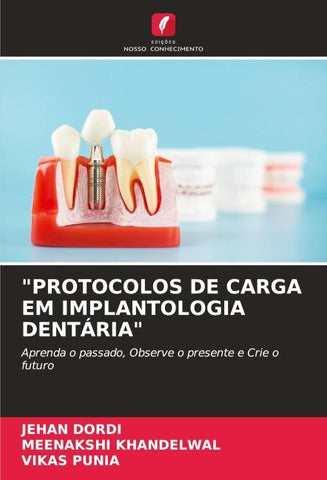 "PROTOCOLOS DE CARGA EM IMPLANTOLOGIA DENTÁRIA"