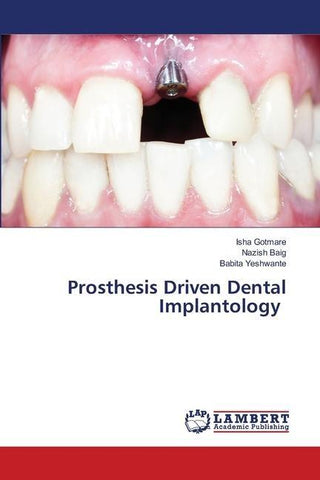 Prosthesis Driven Dental Implantology