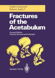 Fractures of the Acetabulum