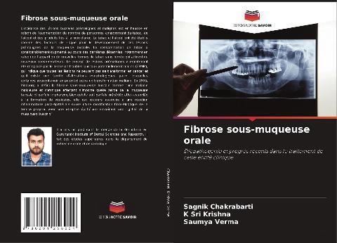 Fibrose sous-muqueuse orale