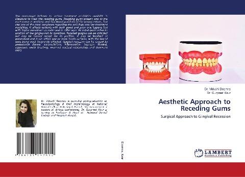 Aesthetic Approach to Receding Gums