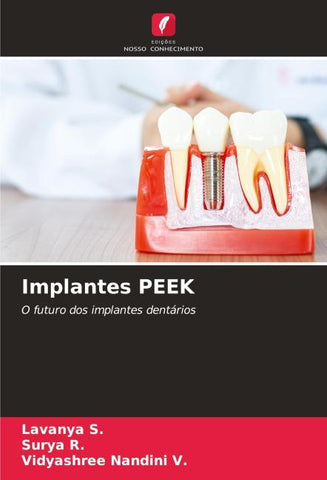 Implantes PEEK