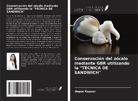Conservación del zócalo mediante GBR utilizando la "TÉCNICA DE SANDWICH"