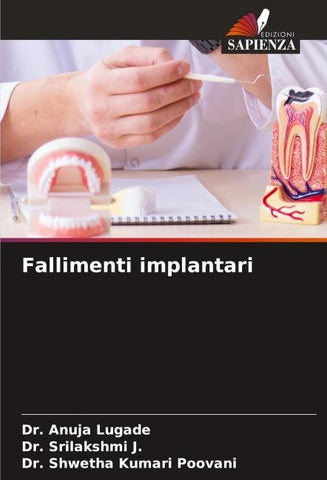 Fallimenti implantari