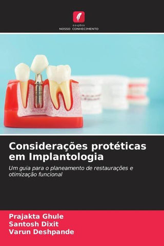 Considerações protéticas em Implantologia