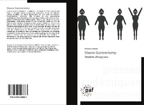 Sleeve Gastrectomy