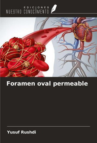 Foramen oval permeable