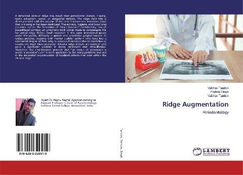 Ridge Augmentation
