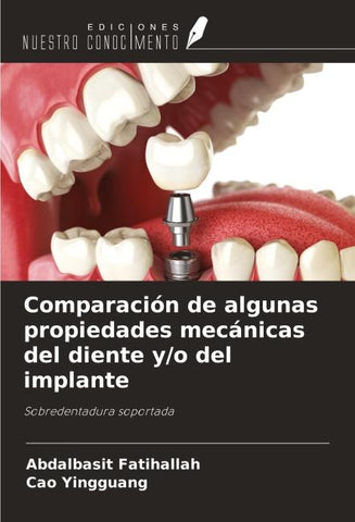 Comparación de algunas propiedades mecánicas del diente y/o del implante