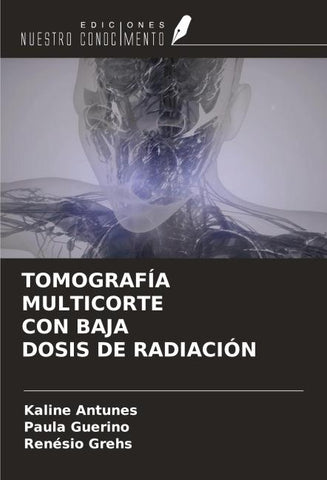 TOMOGRAFÍA MULTICORTE CON BAJA DOSIS DE RADIACIÓN