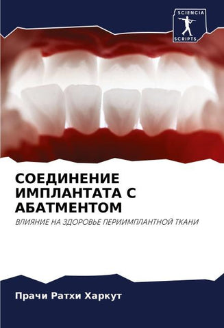 SOEDINENIE IMPLANTATA S ABATMENTOM
