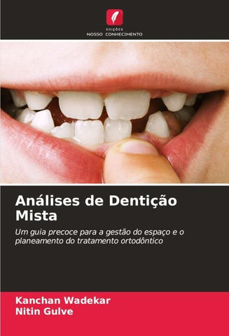 Análises de Dentição Mista
