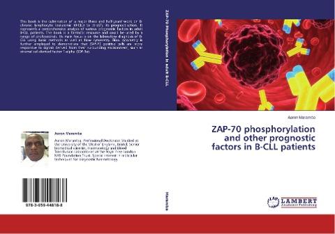 ZAP-70 phosphorylation and other prognostic factors in B-CLL patients