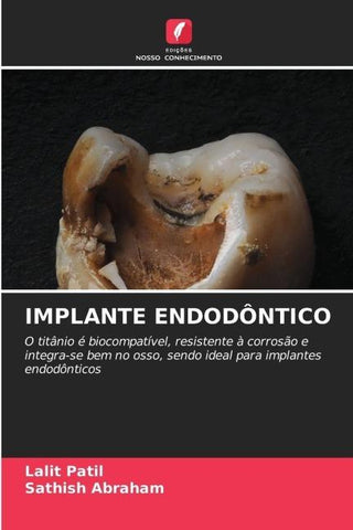 IMPLANTE ENDODÔNTICO