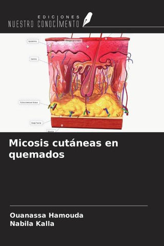 Micosis cutáneas en quemados
