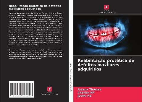 Reabilitação protética de defeitos maxilares adquiridos