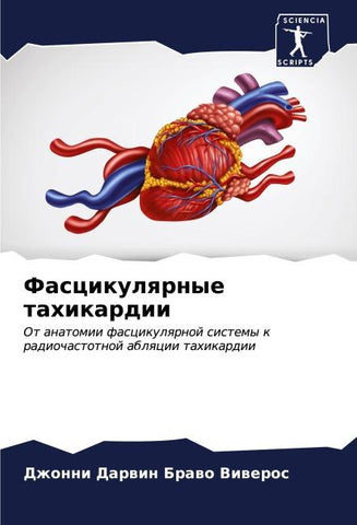 Fascikulqrnye tahikardii