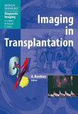 Imaging in Transplantation