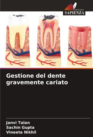 Gestione del dente gravemente cariato