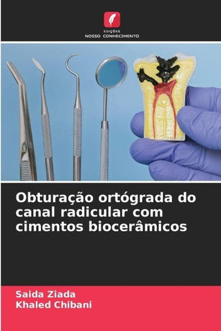 Obturação ortógrada do canal radicular com cimentos biocerâmicos