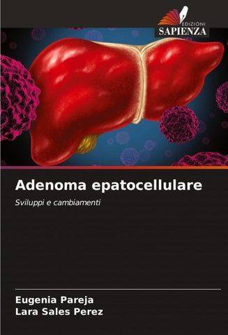 Adenoma epatocellulare