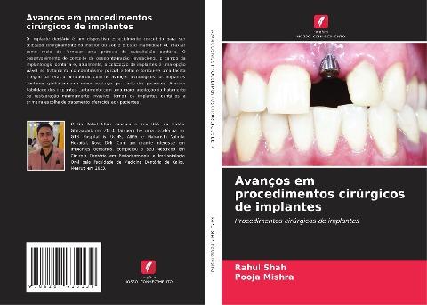 Avanços em procedimentos cirúrgicos de implantes