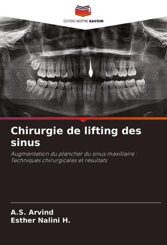 Chirurgie de lifting des sinus