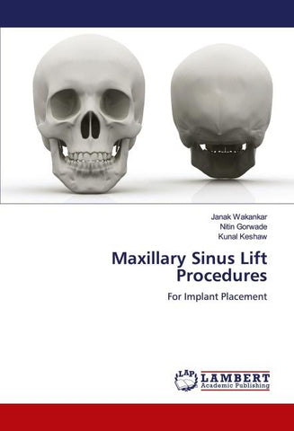 Maxillary Sinus Lift Procedures